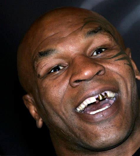 Mike Tyson with Gold Teeth