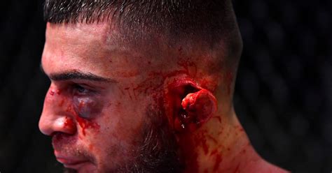 Ramiz Brahimaj UFC Vegas 13 ear damage